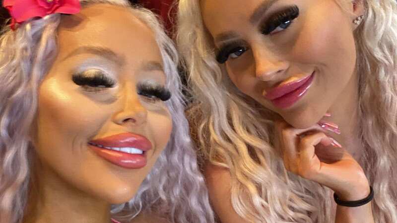 Dolly and Daisy have spent £160K on plastic surgery and cosmetic procedures (Image: Caters News Agency)