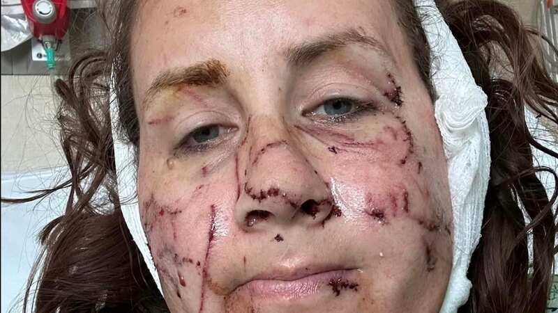 Jen Royce on the mend in hospital (Image: Jen Royce/Facebook)