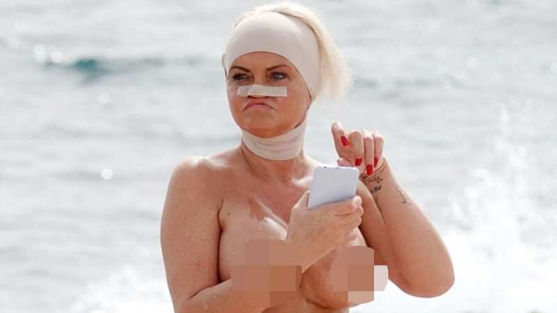 Danniella Westbrook enjoys topless tanning session with bandaged head after hospital dash (Image: BACKGRID)