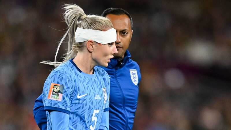 England star Alex Greenwood shows off gruesome bruise from head injury