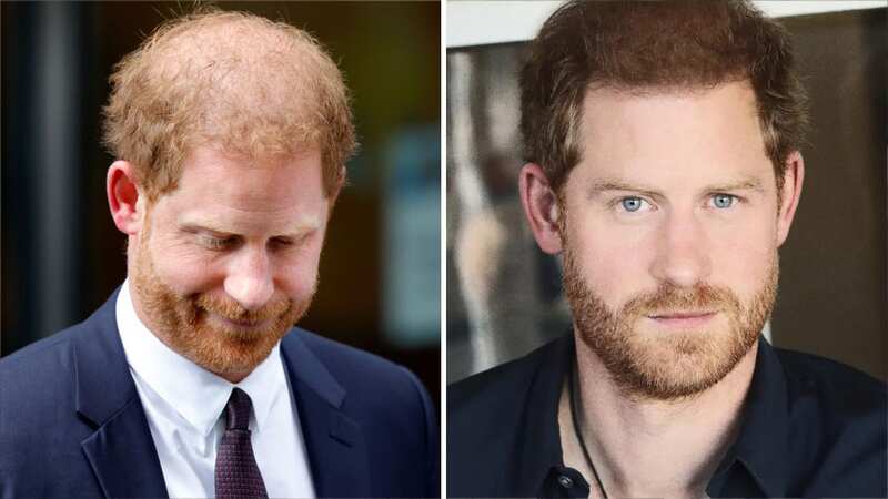 Prince Harry uses Hollywood method to thicken his thinning locks, says expert