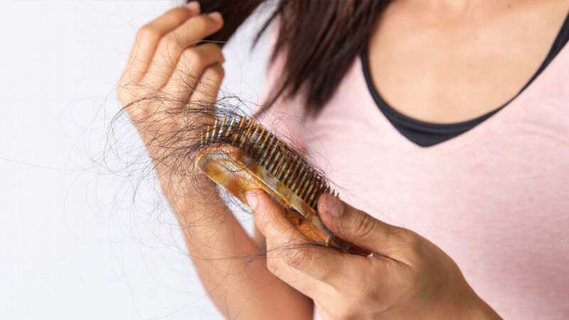 Dreaming of hair loss is quite common (stock photo)