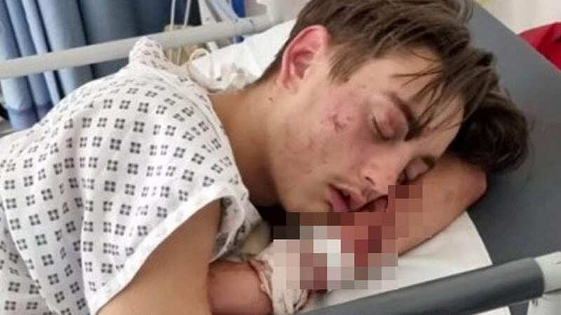 Harvey Aitken, 16, was left for dead in a horror hit-and-run