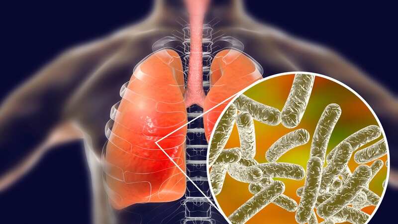 Legionella pneumophila bacteria are the cause of Legionnaires