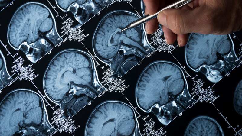 The new technology could save people from dying of brain tumours (Image: Getty Images)