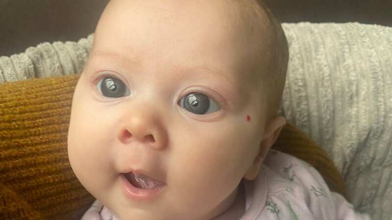 Aretria Bice’s big blue eyes were a symptom of bilateral congenital glaucoma (Image: Louise Claire Bice / SWNS)