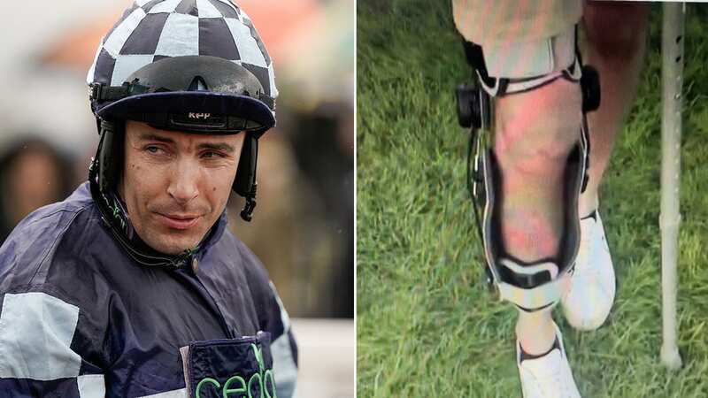 Aidan Coleman and right, the injury he is currently recovering from (Image: Getty/ Sky Sports Racing)