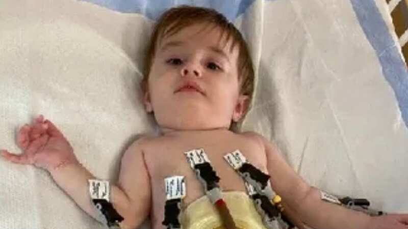 Baby Levi has had 17 surgeries so far (Image: GoFundMe)