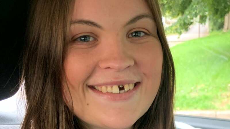 Abbie Smith lost a tooth after having an epileptic seizure (Image: Supplied)