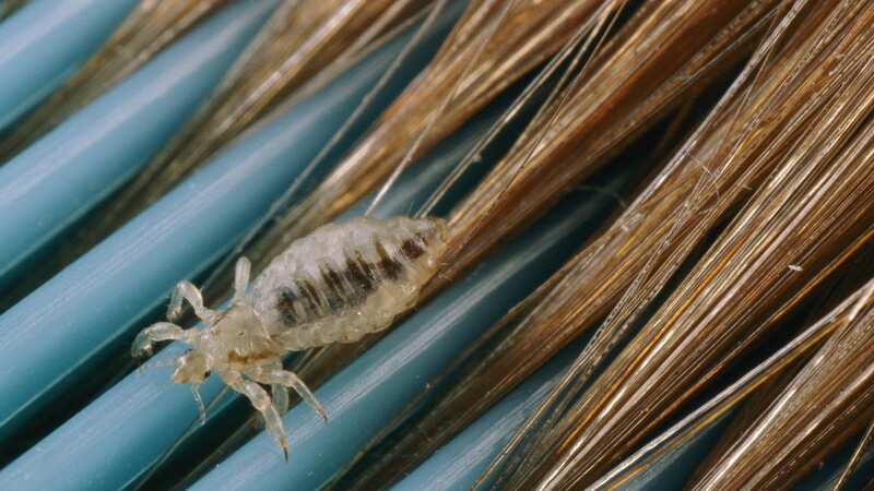 The NHS said traffic to its head lice advice page has soared by a third since term started earlier this month (Image: National Geographic/Getty Images)
