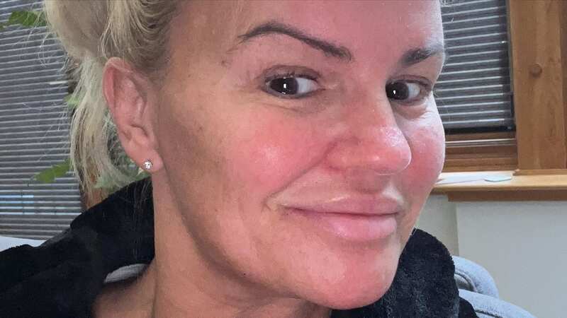 Kerry Katona proudly showed off the results (Image: Instagram/kerrykatona7)