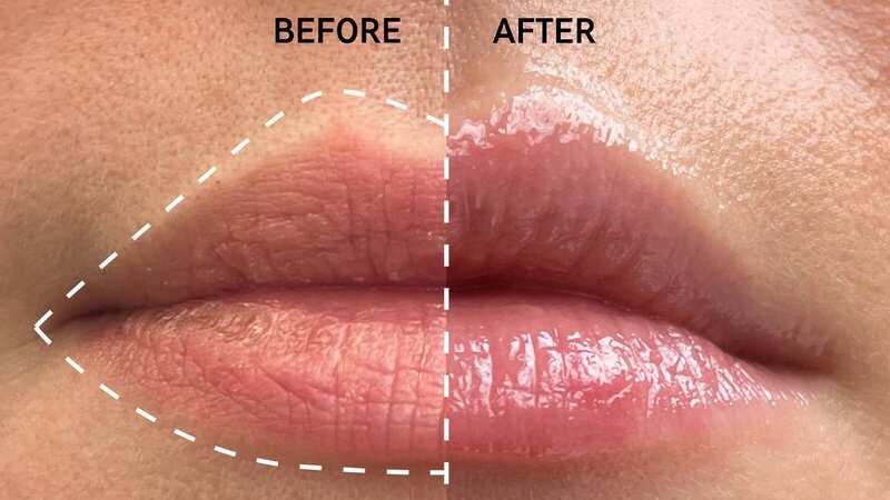 WOW! Would you just look at these amazing results from using The INKEY List Tripeptide Plumping Lip Balm