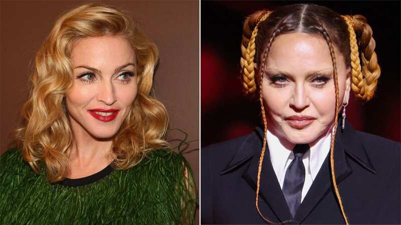 A surgeon has weighed in on Madonna
