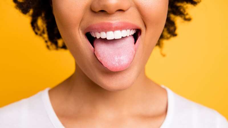 Five telling things your tongue can reveal about health conditions (Image: Getty Images/iStockphoto)