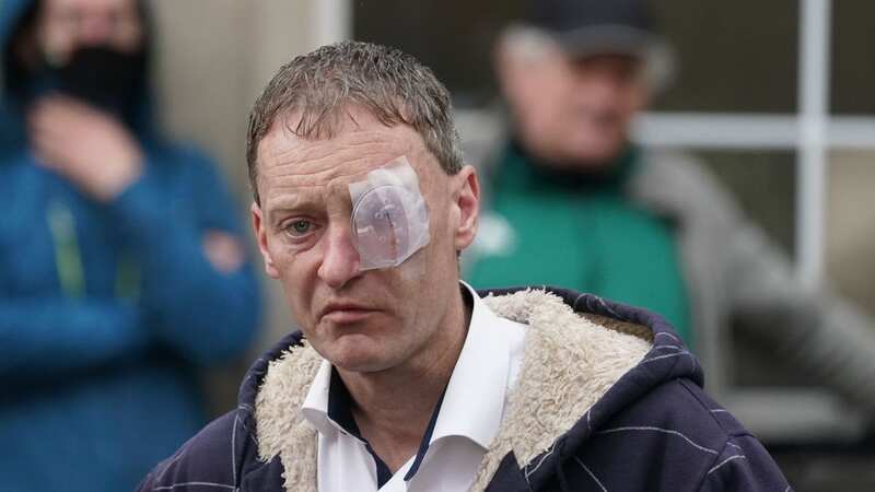 Anthony Burke spoke of being attacked by Yousef Palani - a double killer attacker gay men out of hatred (Image: PA)
