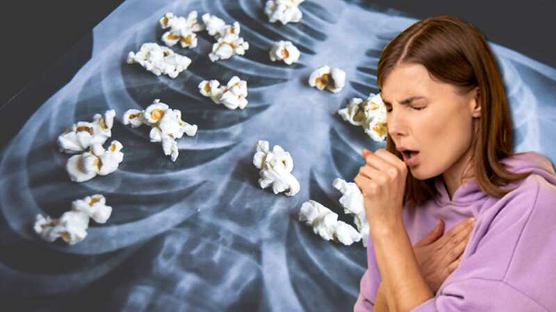 Popcorn lung is a nickname for bronchiolitis obliterans, a condition that damages the smallest airways in your lungs, causing coughing and shortness of breath. (Image: GettyImages)
