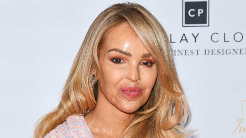 ITV Loose Women Katie Piper reveals she can