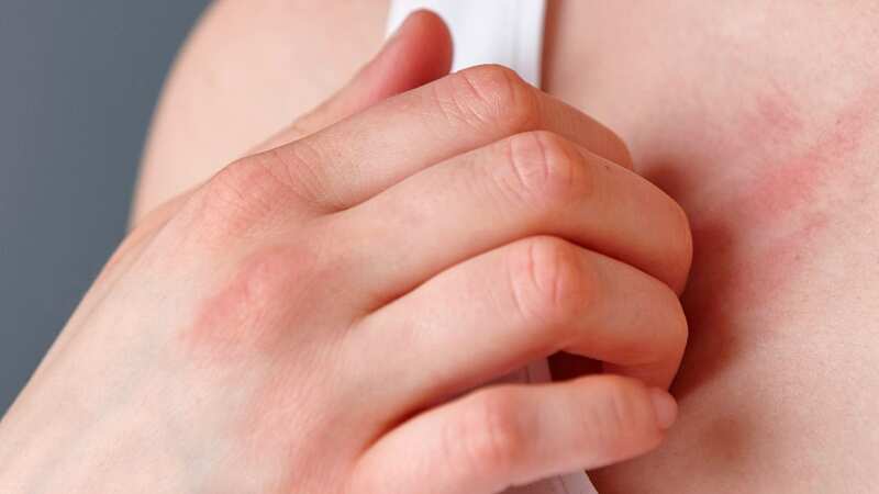 Cropped close up shot of young woman scratching her chest with fingers (Image: Getty Images/Cultura RF)