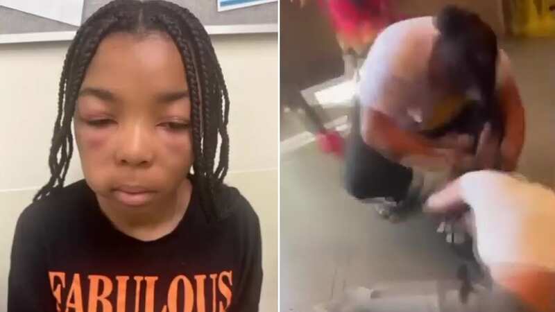Girl beaten up by woman crying 