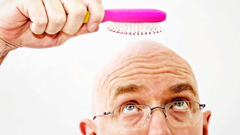 With new treatments, comb overs may soon be a thing of the past. (Image: Getty Images)