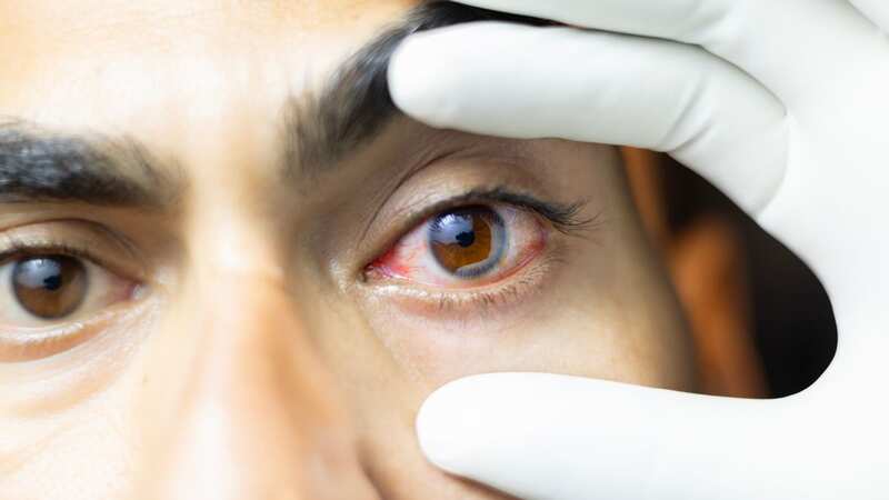 Over two million Brits are at risk of permanently losing their vision due to treatable conditions like glaucoma (Image: Uma Shankar Sharma/Getty Images)