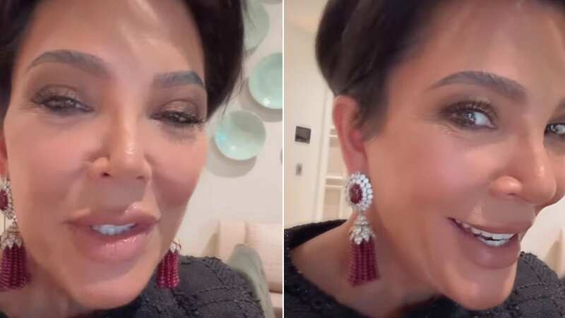 Kris Jenner has admitted to having a facelift and fillers