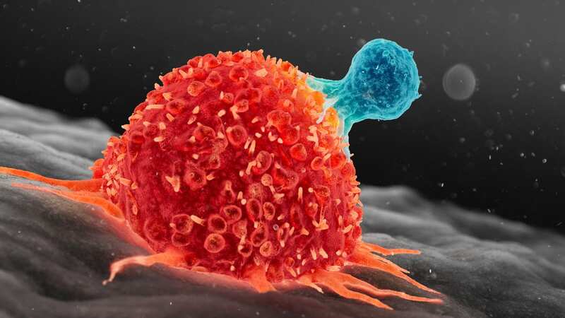 Scientists at UC Davis trigger programmed cell death, unlocking solid tumour treatment possibilities (Image: Getty Images/Science Photo Library RF)