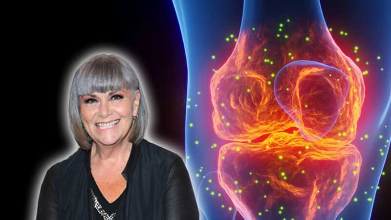 Top comic Dawn French suffers from osteoarthritis, which can be very painful. (Image: Getty Images)