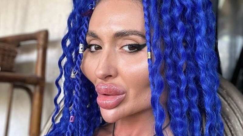Anastasiia has shocked fans with the latest beauty treatment (Image: @justqueen88/instagram)