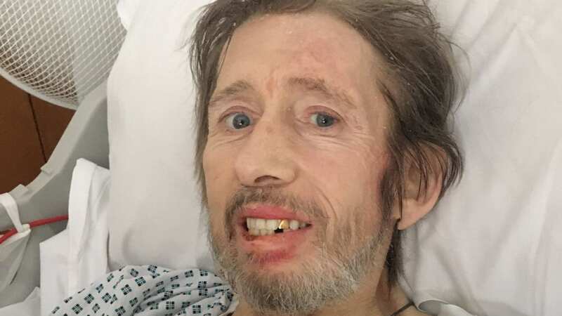 The Pogues star Shane MacGowan