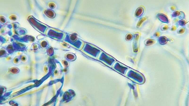 The fungus Trichophyton rubrum under the microscope (Image: Getty Images)