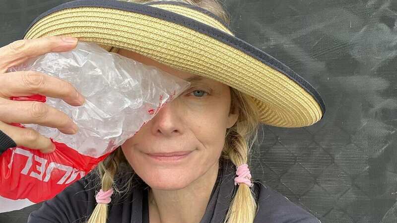 Michelle Pfeiffer shows off black eye in graphic snaps as she gives grim warning