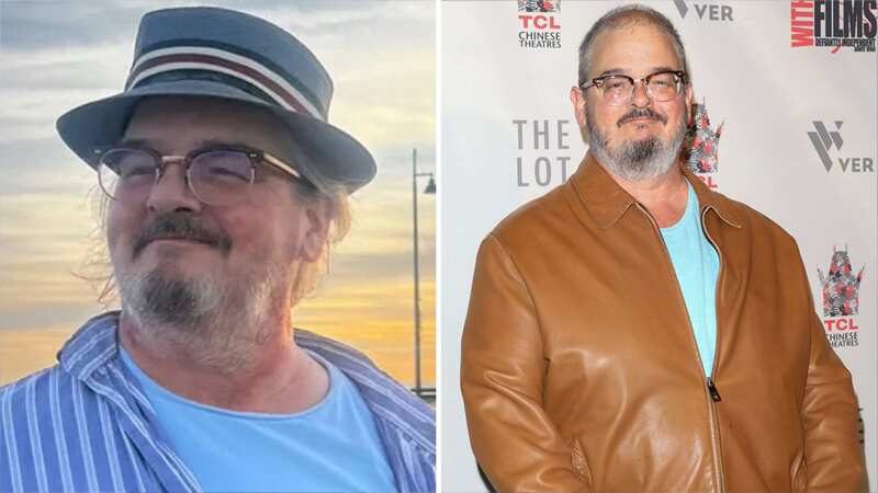 Ken Hudson Campbell has had successful surgery for his cancer (Image: 20th Century Fox)