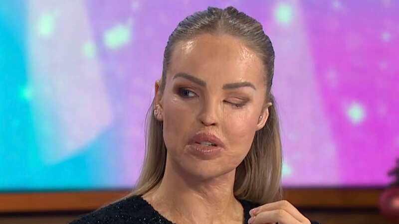 Katie Piper gives health update in live TV return as eye is sewn shut for a year