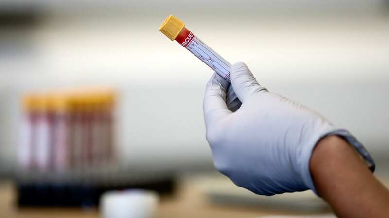 The tests, which are not expensive, use patient blood samples (Image: PA)
