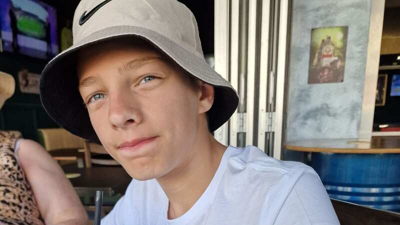 Tyler Skee, 13, had a reaction to a henna tattoo and was left with a weeping wound and rash (Image: Kennedy News and Media)