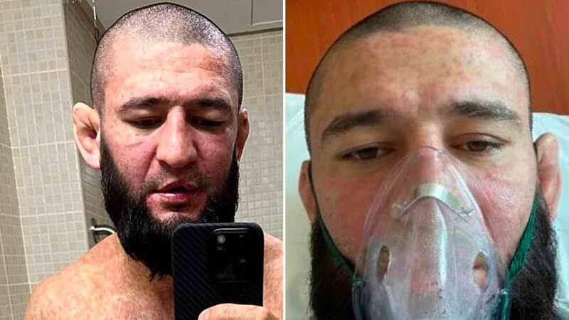 UFC star Khamzat Chimaev left on ventilator in concerning health pictures