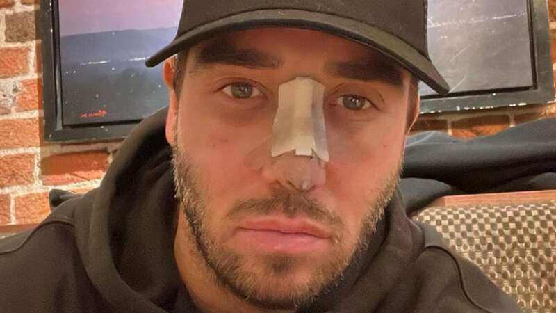 James Lock has shared an update with fans after teasing he was going to have surgery last month (Image: jameslock__ Instagram)