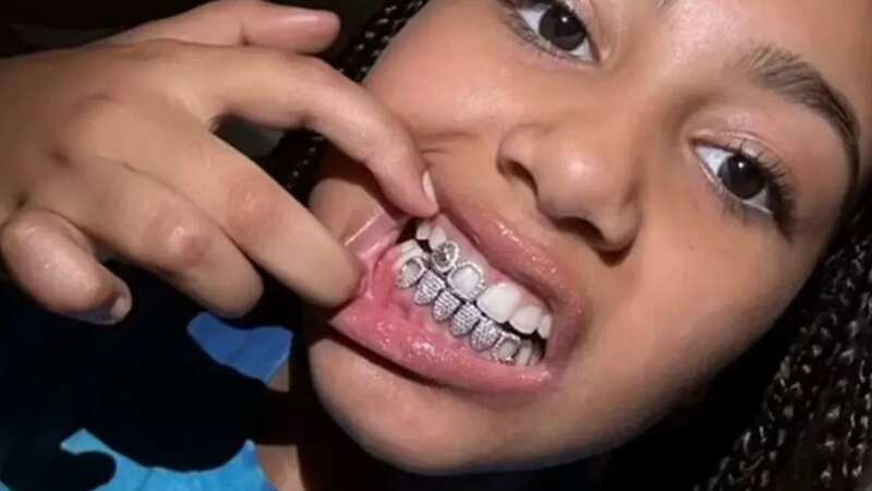 North West shows off new diamond drills after her dad Kanye West gets new dental work