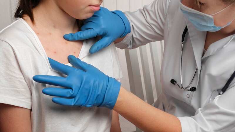 Measles case are on the rise in the UK (Image: Getty Images)