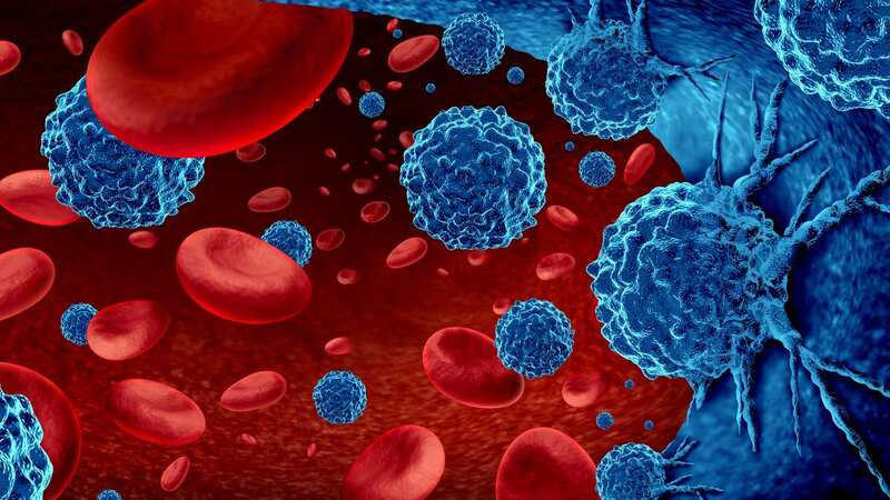 Multiple myeloma causes cancerous white blood cells, called plasma cells, to build up in the bone marrow (Image: Getty Images/iStockphoto)