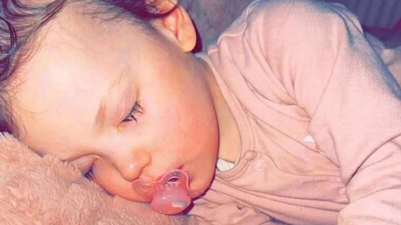 Millie suffered horrific injuries from a wash pod (Image: Kelly Spampinato)