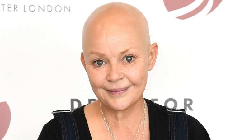 Gail Porter decided not to wear a wig in order to help raise awareness of her condition (Image: iamgailporter/Instagram)