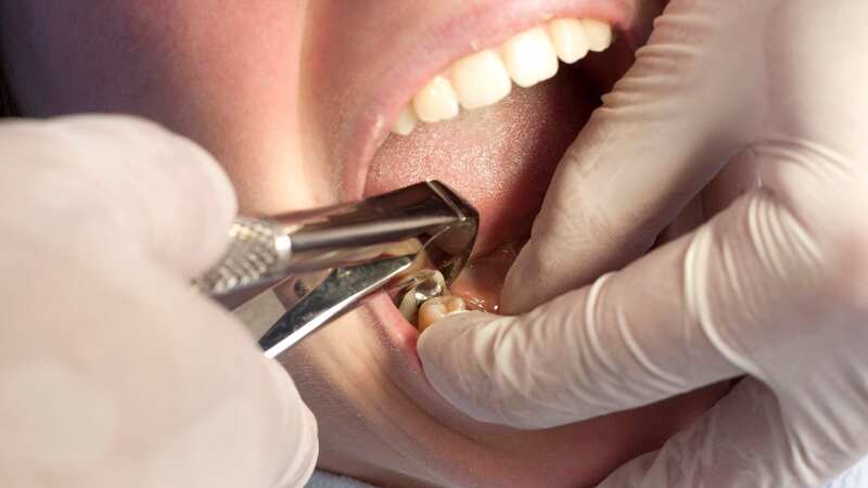 A six-year-old girl had her tooth removed by her mother -with a pair of pliers (Image: Getty Images/iStockphoto)