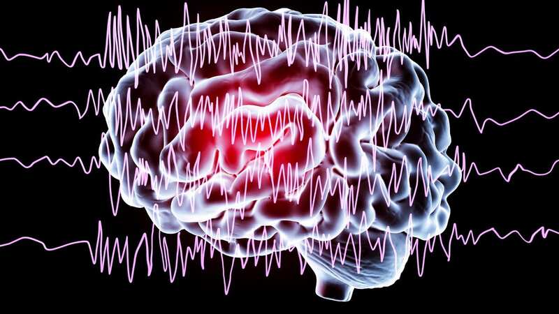Slow brainwaves that usually occur when the brain sleeps are also present in wakefulness for people with epilepsy (Image: Getty Images/Science Photo Library RF)