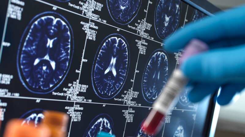 Dementia could be spotted 10 years before symptoms, according to a new study (Image: Getty Images/Image Source)