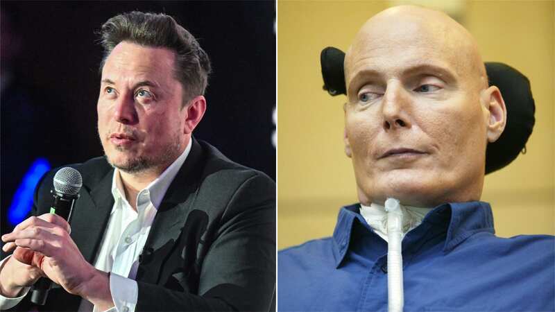 Elon Musk announced that the first Neuralink was implanted in a human (Image: No credit)