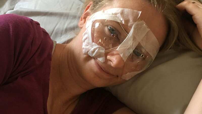 Erin Orchard says she regrets having the eye surgery (Image: Erin Orchard / SWNS)