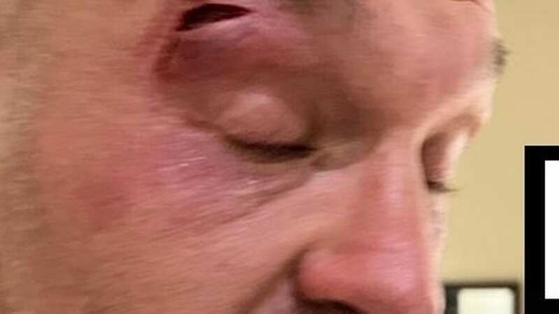Tyson Fury