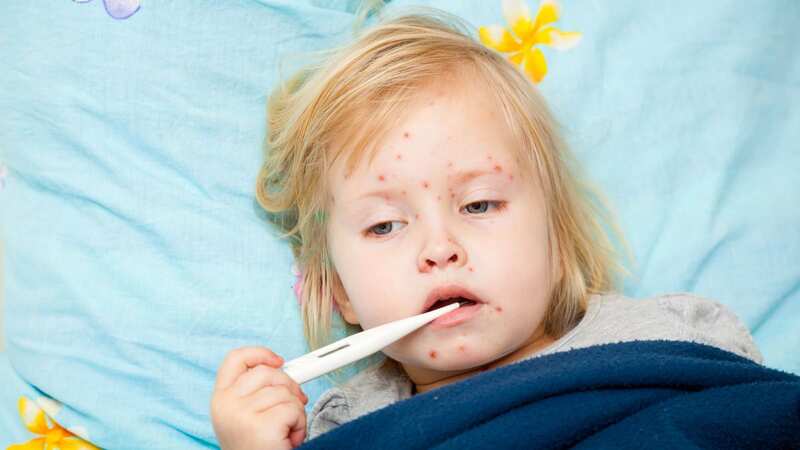 More severe complications can occur in children with measles (Image: Getty Images/iStockphoto)